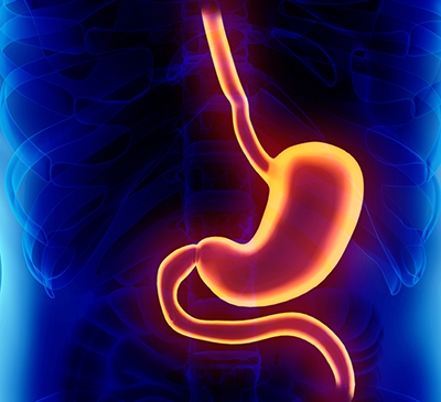 Intragastric Balloons Market by Product and Geography - Forecast and Analysis 2020-2024